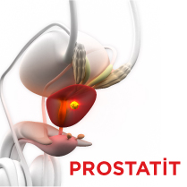 Prostatit Nedir